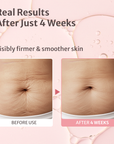 Body Oil for Firmness & Texture Refinement