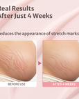 Belly Cream for Elasticity & Stretch Mark Care