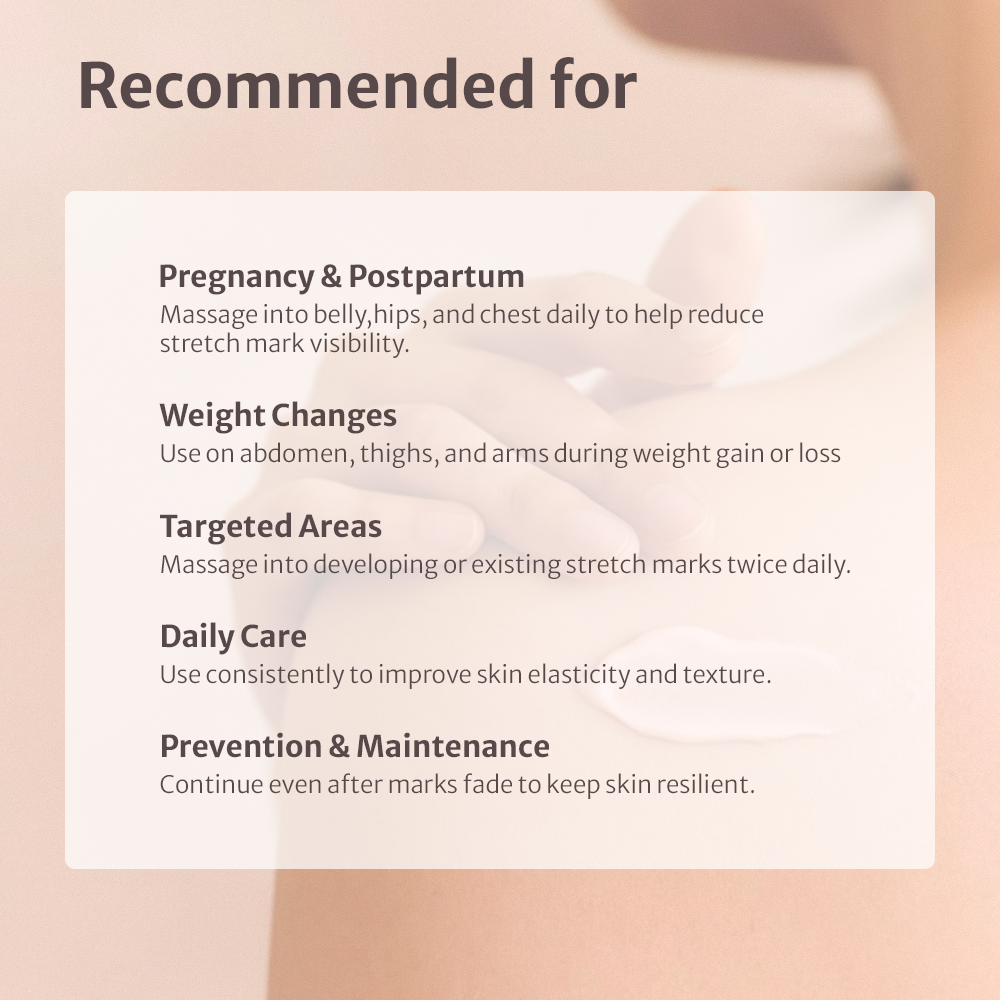 Belly Cream for Elasticity &amp; Stretch Mark Care